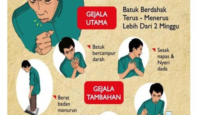 Waspada TBC, Jangan Abaikan Batuk yang Tak Kunjung Sembuh